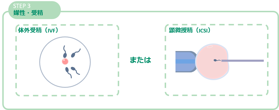 北関東の不妊治療は 群馬県高崎市 高崎artクリニック 不妊の理由を探り 患者さまお一人おひとりに合わせた治療を掲げています